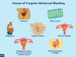 Bleeding Or Spotting Between Periods Causes And What To Do