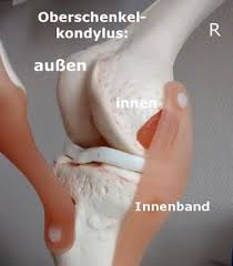 Die stetigen belastungen, denen die gelenke in den beinen unterliegen, sind immens. Schmerzen Im Knie Warnsignal Oder Harmlos Knie Marathon Knie Op Reha Patienten Aufgepasst