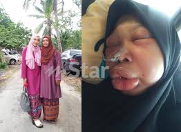 Doktor biaanya mengkategorikan barah payudara mengikut peringkat, berjumlah 0 hingga 4. Tak Boleh Cakap Lidah Mak Keras Sepenuhnya Bermula Dari Ulser Kini Leher Berlubang Anak Kongsi Derita Ibu Hidap Kanser Viral Mstar