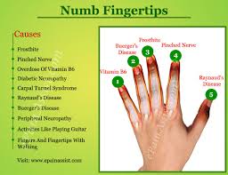 Pin On Diseases And Conditions