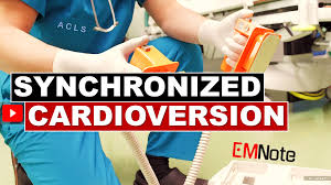 Image result for Synchronized Cardioversion
