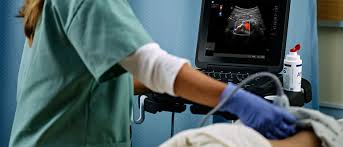 Ultrasound System Fujifilm Global