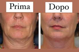 ICOONE LASER: IL TRATTAMENTO VISO