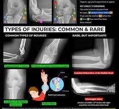 Pin By Marija Kljajic On Radiography Pediatric Radiology Diagnostic Imaging Medical Knowledge