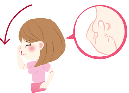 Nasal sprays are a solution or suspension of medicine. Nose Bleeds Dr Schneiderman