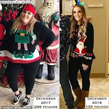 Desiree Mize shows off her 150lb weight loss of 150lbs in one year after  gastic bypass surgery
