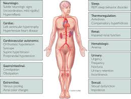 We use this information to improve our site. Pure Autonomic Failure Mayo Clinic Proceedings