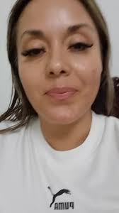 Piel Apiñonada Mujer