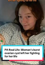 Ovarian Cyst Emergency: Daisy Wilson's Life-Changing Story