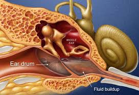 Anatomy Of An Ear Infection