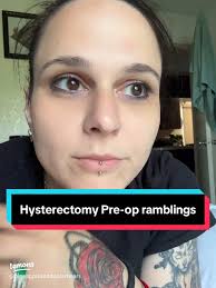My Hysterectomy and Ovary Removal: A Personal Journey