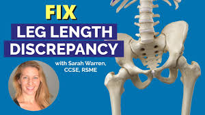 Image result for Functional Leg Length Discrepancy