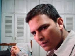 People balding in their 20s