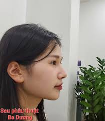 Thẩm Mỹ Viện Bs Bạch Dương