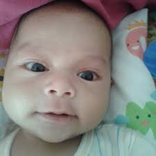 Ubat Ruam Pada Muka Bayi Rawatan X