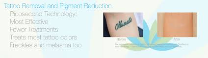 Making the world more beautiful, one client at a time. Tattoo Removal