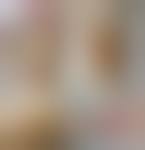 Image result for Pyoderma Gangrenosum