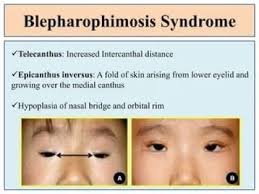 Image result for Blepharis transvaalensis