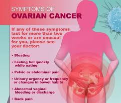 The problem with ovarian cancer is that it can be asymptomatic in its earliest stages; Stage 4 Ovarian Cancer Bloating Pictures Cancerwalls