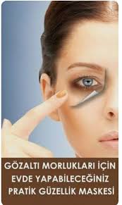 Goz Alti Morluklarina Bitkisel Cozum Dark Circles Under Eyes Dark Circle Remedies Eye Treatments