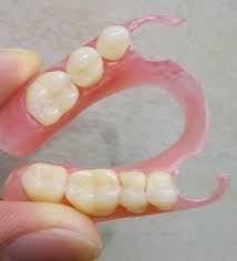 Asesor twk kpk gebrak meja, lecehkan perempuan. Gigi Palsu Murah Dan Nyaman Doktergigi Id