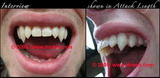 We did not find results for: Teeth By Dnash Custom Vampire Fangs Werewolf Teeth And Dental Effects Custom Fang Styles