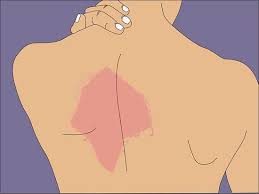 How To Get Rid Of Knots In Your Back Health Fitness Massage Therapy Body Health