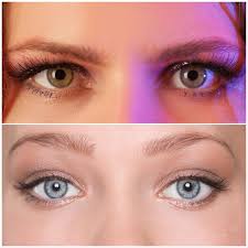 Maybe you would like to learn more about one of these? Botox Brow Lift Everything You Need To Know Natural Injector