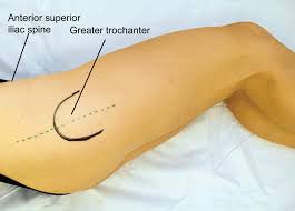 Tendinitis is inflammation or irritation of a tendon — the thick fibrous cords that attach muscle to bone. Applied Basic Sciences Section 5 Postgraduate Orthopaedics