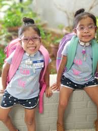 Formerly conjoined twins now 5 years-old, start attending Pre-K
