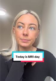 How many times did I say MRI in that painful video 😂 Hair has started to  grow back, look at the fuzz 🥹