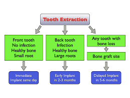 Saving teeth — when severe periodontal disease causes bone loss, teeth can become loose and at. How Long After A Tooth Extraction Can You Get An Implant How Long After A Tooth Extraction Can You Get An Implant Kazemi Oral Surgery Facialart Com