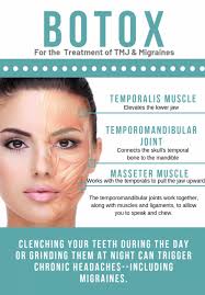 How long for botox to work for migraines. Pin On Botox