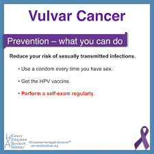 Image result for Vulvar Cancer