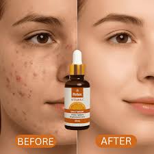 Relax UK Vitamin C Serum | 30ml – BestMartPk
