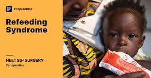 Image result for Refeeding Syndrome