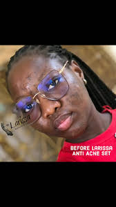 Larissa Soap Before and After