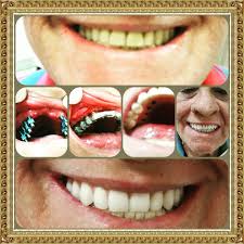 Dr.Cleomenes Jr. Implantodontista