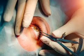 Oculoplastic Care