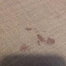 How To Get Blood Out Of A Couch Best
