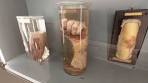 Pathologisch-anatomische Sammlung im Wiener 