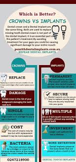 A crown (also called a. After Root Canal Treatment Is Crown Necessary Edukasi News