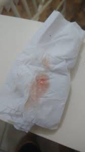 Sangramento Rosado 6 Semanas E 4 Dias Minha Primeira Gravidez Babycenter