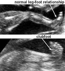 Pin On Ultrasound Notes