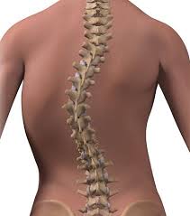One end is pulled by the muscle to create movement. Muscular Imbalance Why Does Scoliosis Create One Weak Side