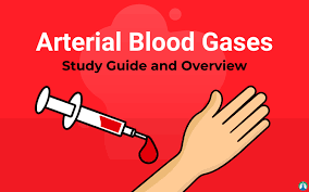 Blood gas interpretation ayman i. Abg Interpretation The Ultimate Guide To Arterial Blood Gases