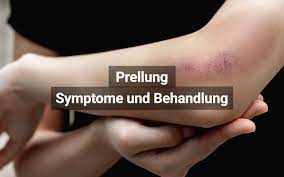 Prellung Symptome Behandlung Dauer Praktischarzt
