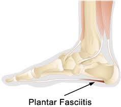 Pin On Footeez Free Your Feet While You Sleep