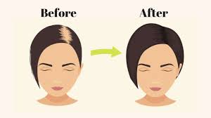 Hair loss in your 60s and beyond. What Causes Hair Fall Ways To Grow Your Hair Naturally Medy Life