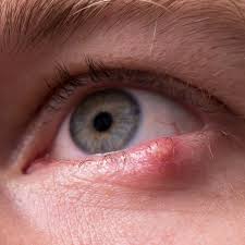 Image result for Styppeiochloa